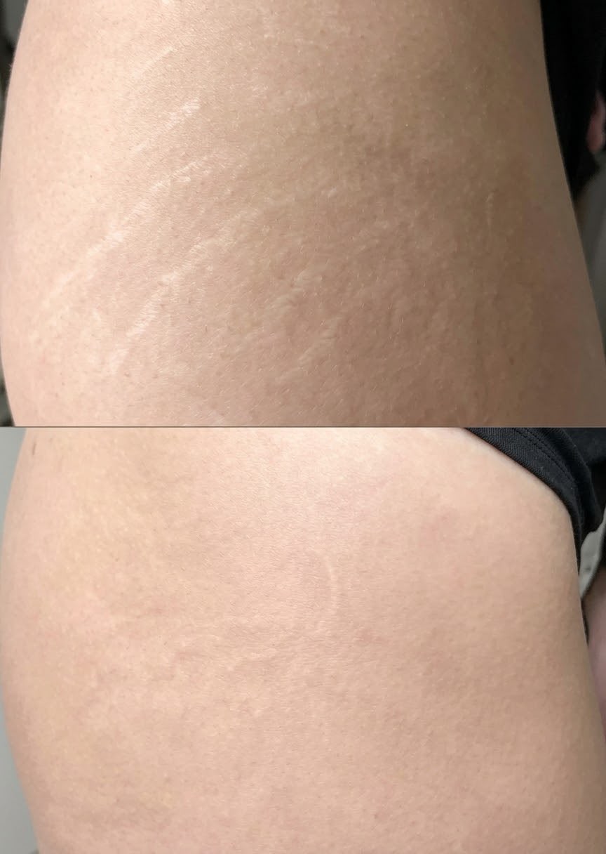 Reparação Tecidual